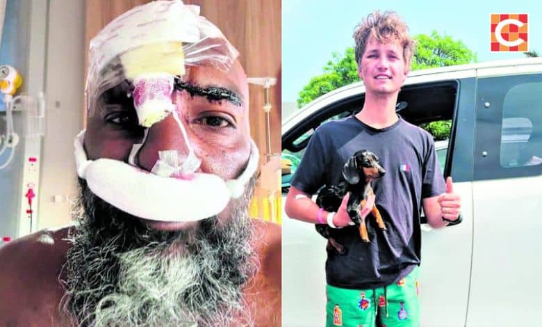 Cape Vidal hyena attacks: Victims tell of lasting trauma | Network News